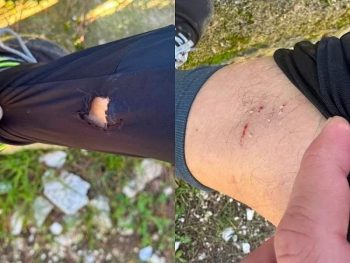 Πολίτες δέχτηκαν επίθεση από αδέσποτα σκυλιά στο περιαστικό Δάσος Φρόντζου